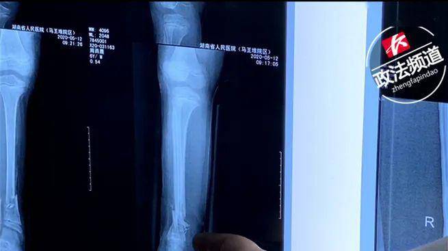 洋葱出芽可以吃么